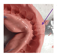 alginate-3b