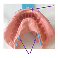 alginate2a