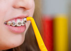 ortho-oral-health-